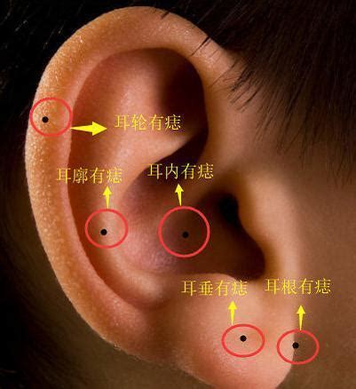 耳根有痣|耳朵长痣的位置图解 耳朵长痣的位置图解有福气